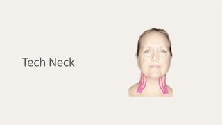 Reduce neck wrinkles with Face Taping [upl. by Nainatrad]