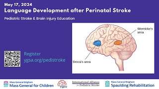 Language Development after Perinatal Stroke [upl. by Kazimir]