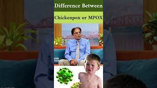 Chickenpox amp MPox Causes Symptoms amp Treatment  Dr Atif Kazmi Explains [upl. by Abbot]