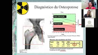 AULA DENSITOMETRIA ÓSSEA  PARTE 01 [upl. by Aniv]