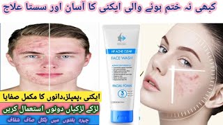 Hp acne Acne clear face wash Honest review  Best Oil control face wash  3 in one solutionfacewash [upl. by Faux993]