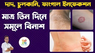 6 Home Remedies for Itching Problem In Private Parts Skin Fungal Infection দাদহাজাচুলকানি । [upl. by Ecinert]