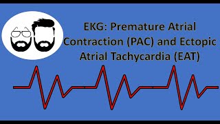 EKG Series Premature Atrial Contraction PAC and Ectopic Atrial Tachycardia EAT [upl. by Aikim962]