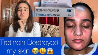 Quitting Tretinoin  Tretinoin destroyed my skin😭😫 [upl. by Sirmons]