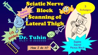 Ultrasound Scanning Principles for Supine Lateral Sacral Plexus or Sciatic Nerve Block DrTuhinM [upl. by Sackman]