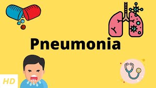 Pneumonia Causes Signs and Symptoms Diagnosis and Treatment [upl. by Yl]