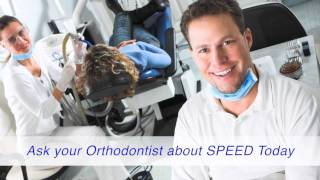 Speed Braces at Austin Orthodontic Artsmov [upl. by Bergmans30]