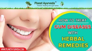 How to Treat Gum Diseases with Herbal Remedies Naturally [upl. by Schilling]