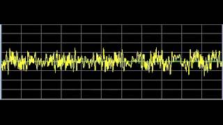 Eczema Relief  Rife Frequencies [upl. by Eartnoed326]