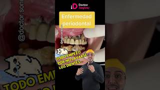 El cepillado dental es esencial dentista shorts periodontitis gingivitis humor [upl. by Einnad]