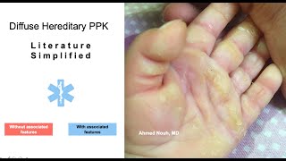 A Clinical approach to Palmoplantar Keratoderma [upl. by Ramsdell]