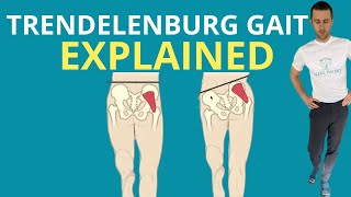 Trendelenburg Gait Explained [upl. by Notnroht63]