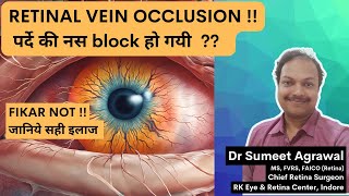 पर्दे की नस block हो जाए Retinal Vein Occlusion तो क्या करें [upl. by Ainelec235]