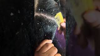 REUPLOAD DANDRUFF SCRATCHING [upl. by Heady]