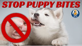 Help How Do I STOP Puppy Biting 17 [upl. by Gloriana415]