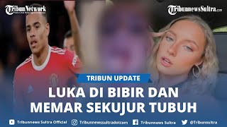 Viral Pemain MU Mason Greenwood Hajar Kekasihnya Harriet Robson Memar hingga Luka di Bibir [upl. by Dowlen]