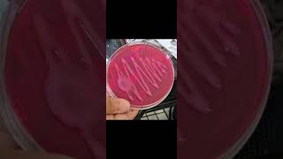 Macconkey agar microbiology macConkeyagar microbiology agar [upl. by Hyacinthie]