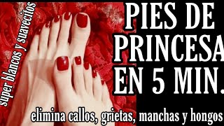 PIES DE PRINCESA en 5 Min ELIMINA callos grietas hongos blanquea e hidrata [upl. by Anilatsyrc568]