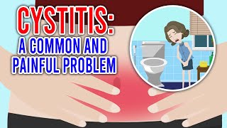 CYSTITIS Its Causes Symptoms and Treatment [upl. by Hitoshi253]