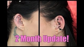 Helix Piercings 2 Month Update  MASSIVE KELOIDS [upl. by Swithbert]