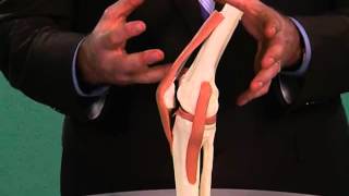 Bursitis  Serious Accidents Can Affect Knee Movement [upl. by Jeni]