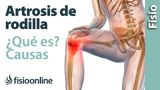 Bursitis de Rodilla ¿como se da Tratamiento frió  calor  Estiramiento [upl. by Nostrebor]