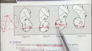 FETAL HEAD DIAMETER OBstetrics [upl. by Liban]