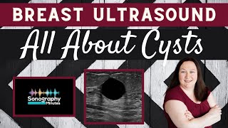 Breast Ultrasound  All About Breast Cysts  Sonographyminutes [upl. by Nimoynib695]