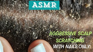 ASMR  AGGRESSIVE SCALP SCRATCHING WITH FINGERS ONLY [upl. by Enilasor]