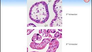 Grand Rounds Endocrinology of the MaternalFetalPlacental Unit [upl. by Arimat]