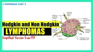 Lymphomas Made Easy  Hodgkin vs the NonHodgkin Lymphomas  Usmle Hematology Speedy Medical [upl. by Anaila]