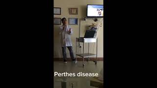 Perthes Disease in Children Legg Perthes Disease [upl. by Bary]