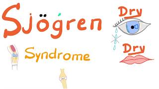 Sjögren Syndrome  Dry eyes Dry mouth Arthritis  Rheumatology Series [upl. by Alegnad]