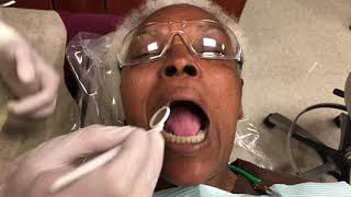 Part 2 of EampI Intraoral Examination [upl. by Reid]