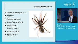 Gary Bain The Great Aussie Bite Mycobacterium ulcerans Down Under [upl. by Atlas756]