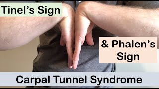 Carpal tunnel syndrome  Tinel’s sign and Phalen’s sign  Clinical Examination [upl. by Hermina640]