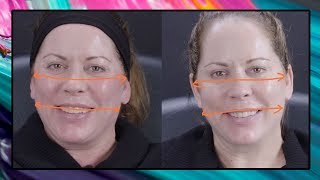 How Fillers Can Actually Make Your Face Look Slimmer  Dr Sarah Tonks [upl. by Shaina]