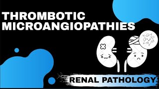 THROMBOTIC MICROANGIOPATHIES  Renal Pathology   Med Bees [upl. by Mobley]