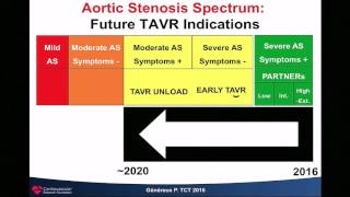 7 Aortic Stenosis Upcoming Treatment Strategies  Philippe Généreux [upl. by Ahtel]