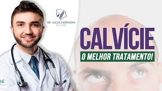 CALVICE e QUEDA DE CABELO Qual o Melhor Tratamento  Dr Lucas Fustinoni [upl. by Annaiek383]