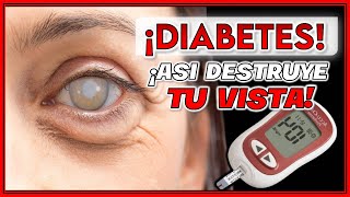 Los PRIMEROS SÍNTOMAS de RETINOPATÍA DIABETICA ¡PÉRDIDA de VISIÓN por DIABETES [upl. by Hamish]