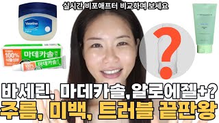 마데카솔 사용자 99가 모르는 주름 미백 보습 트러블 한방에 잡는 마데카솔겔 바세린 알로에젤 팩 방법  효과 미쳤다 돈 한 푼 안 들이고 0원 이것 으로 20살 [upl. by Fernando260]