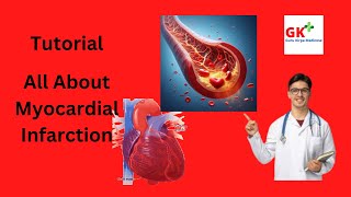 Myocardial Infarction Etiology Pathophysiology Symptom and Treatment [upl. by Ylek]