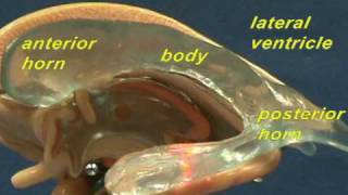 Brain Stem Model  Lateral amp Third Ventricles [upl. by Shalne]