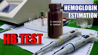 Haemoglobin Test Procedure  Hgb Blood Test Method  Blood Hemoglobin [upl. by Wang216]