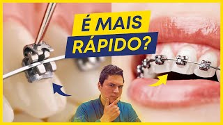 COMO FUNCIONA O APARELHO AUTOLIGADO É VERDADE QUE É MAIS RÁPIDO [upl. by Creighton]