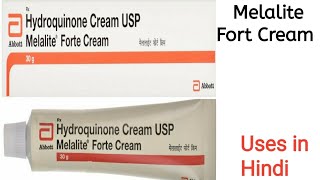 Melalite Forte Cream uses side effects and doses in Hindi [upl. by Johann198]