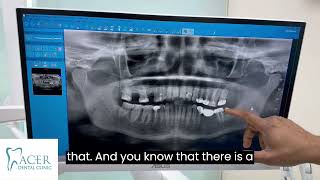 Understanding Panoramic XRays A Complete Dental Guide [upl. by Decker809]