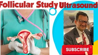 Follicular Study Ultrasound  Ovulation Study ultrasoundajaykaushik [upl. by Negeam]