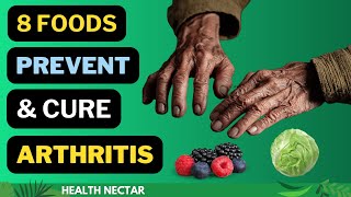 Become Arthritis Free Top 8 Foods to Prevent and Cure Arthritis [upl. by Nyletak]